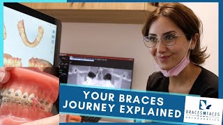 Your Braces Journey Explained Start to Finish  Braces N Faces Orthodontic Clinic Hoppers Crossing [upl. by Kafka]