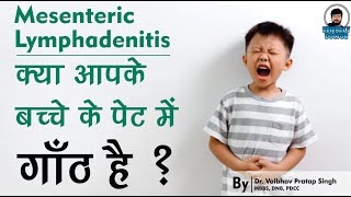 Mesenteric Lymphadenitis  क्या आपके बच्चे के पेट में गाँठ है [upl. by Wiener422]