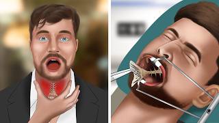 ASMR Animation Remove fish bones stuck in MrBeasts throat [upl. by Ardnama537]