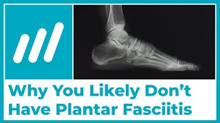 Are You Sure Your Have Plantar Fasciitis [upl. by Hafinah]