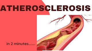 Atherosclerosis in 2 minutes [upl. by Elsi7]