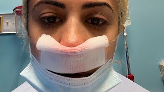 Septoplasty Surgery Experience [upl. by Lloyd]