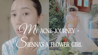 Finally Opening Up About My Acne Sienna’s First Time as a Flower Girl and Moments at CokoroHaus [upl. by Atteuqaj240]