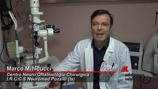 Cheratocono patologia degenerativa della cornea [upl. by Ahsiekyt]