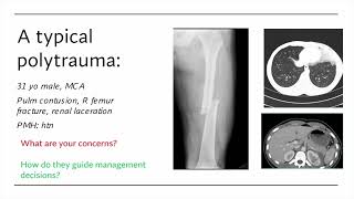 VTE Prevention in ortho trauma Is it time for aspirin [upl. by Anayia]