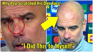 Pep Guardiola Explains Bizarre Scratches After Man City’s Shocking 33 Draw vs Feyenoord [upl. by Atneciv]