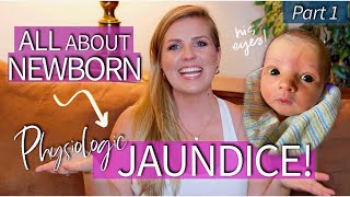 Newborn Jaundice Everything You Need to Know  Sarah Lavonne [upl. by Enytsuj]