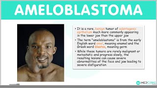 Ameloblastoma Types Clinical Features Diagnosis Differentials and Management [upl. by Brigitta]