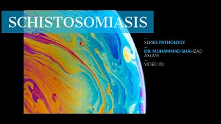 Schistosomiasis  YouTube Journal Club Learning PathologyV80 [upl. by Nnairda]