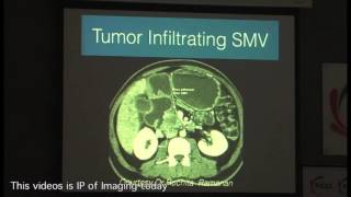 Radiology approach to “Pancreatic Carcinoma from a surgeon’s perspective” [upl. by Yelrebmyk]