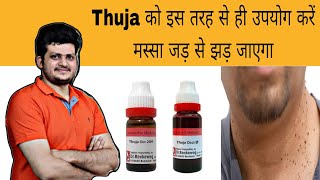 Thuja इस तरह से उपयोग करें मस्सा जड़ से झड़ जाएगा  Warts  Homeopathic Medicine  How to use [upl. by Britni]