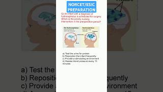 Hydrocephalus mcqs nursingmcq paediatrics cation medicalstudentquiz [upl. by Rebme]