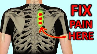 quotRhomboid Painquot How To Fix Shoulder Blade Pain Quickly [upl. by Ewart]