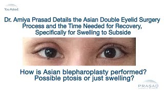 The Asian Double Eyelid Surgery Process and Why Temporary Swelling Occurs [upl. by Salazar539]