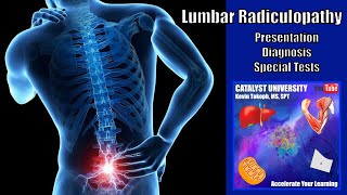 Lumbar Radiculopathies  Presentation Diagnosis amp Special Tests [upl. by Anilocin]