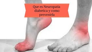 Que es neuropatia diabetica y como prevenirla [upl. by Seema]