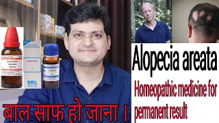 Homeopathic medicine for Alopecia areata  explain everything  permanent result [upl. by Charis413]