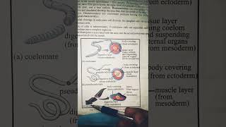 acoelomatespseudocoelomatescoelomate part1 [upl. by Rozanne]