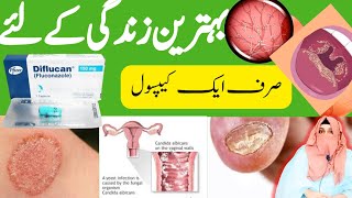 Fluconazole 150 mg uses  Diflucan 150 mg capsule uses in urdu  Diflucan  Dr Rida Ahmed [upl. by Acila]