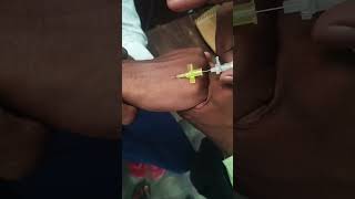 IV Cannula insertion technique shorts​vigo​ लगाना सीखेmedicalstudent​prectice​ timetrending​vi [upl. by Laamaj]