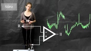 ECG common artefacts and how to avoid them [upl. by Noired]