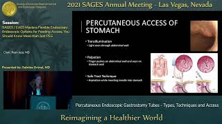 Percutaneous Endoscopic Gastrostomy Tubes  Types Techniques and Access [upl. by Yarised]