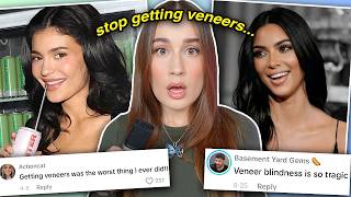 VENEERS ARE RUINING YOUR LIFE scientifically proven [upl. by Aracaj771]