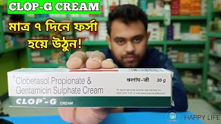 Clop g cream For Skin whitening In Bengali  Clop g cream review amp Uses in Bengali [upl. by Luke738]