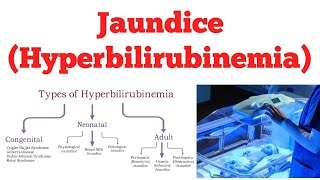 Hyperbilirubinemia  Jaundice  Biochemistry [upl. by Kassab52]