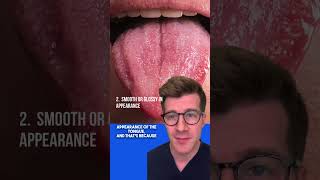 Signs of IRON DEFICIENCY ANAEMIA in the TONGUE  Glossitis explained shorts health anaemia [upl. by Lorain]