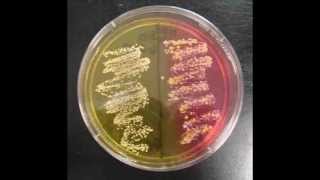 How to Interpret Mannitol Salt Agar Bacterial Growth Medium [upl. by Norag]