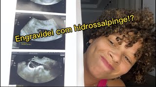 Engravidei mesmo com a hidrossalpinge [upl. by Oedama]