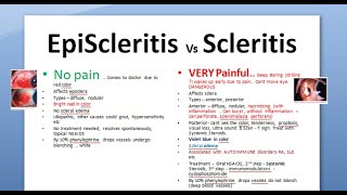 Ophthalmology 150 EpiScleritis Scleritis Difference periodica phenylephrine blanching scleromalacia [upl. by Ainnos]