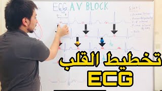 ECG Atrioventricular block AV block سلسلة تخطيط القلب الدكتور عبدالله [upl. by Ahtibbat645]