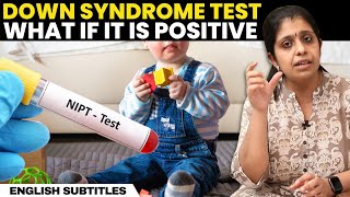 Down Syndrome Test  What If It Is Positive  டவுன் சிண்ட்ரோம் இருப்பதை எப்படி தெரிந்து கொள்வது [upl. by Nosmas]