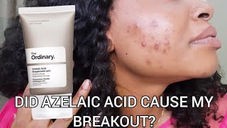 The Ordinary 10 Azelaic acid Suspension for Acne and Hyperpigmentation on Dark skin Review [upl. by Ymrej]