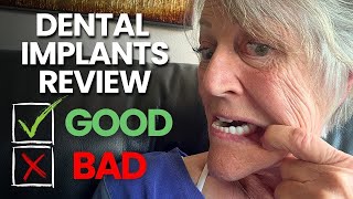 10 Problems With My Dental Implants  3 Years Later [upl. by Fannie183]