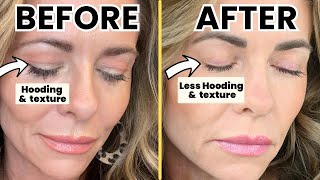 DIY HOODED EYES Fix  TCA Peel Treatment at Home Guide [upl. by Aihsiek547]