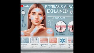 Pityriasis Alba PA [upl. by Annawek158]