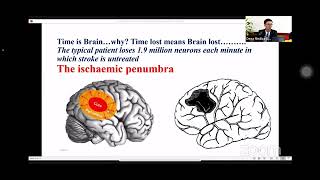 Management of ischemic stroke by Dr Sim Sophana [upl. by Giwdul]