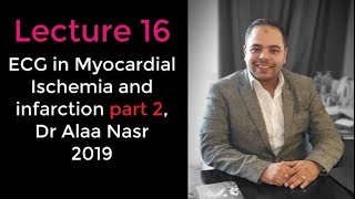 ECG from A to Z 016Alaa nasr2019 myocardial ischemia and infarction part 2 [upl. by Ailuy537]