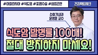 식도암 발병률 최대 100배 절대 지나치면 안 되는 quot이 증상quotㅣ아칼라지아 포엠수술 소화기내과 윤영훈 교수 [upl. by Arimihc]