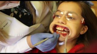 How braces are put on your teeth Full procedure Easy amp Painless [upl. by Ennoitna]