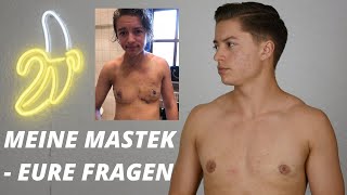 QampA  ich beantworte eure Fragen zu meiner MastektomieBrustoperation  FTM TRANSGENDER [upl. by Harp]