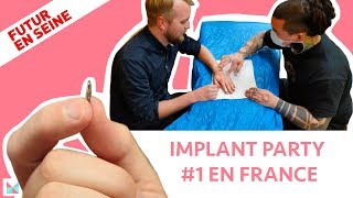 Implant Party 1 en France [upl. by Jozef75]