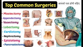 Top 15 Common Surgeries  You Should Know  mastectomy Appendectomy Lobectomyamp More [upl. by Eseela822]