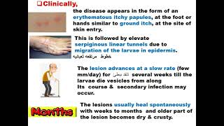 Parasitology ASU GIT Ancylostoma caninum amp Toxocara Dr Khaled Habib [upl. by Iznil]