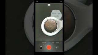 Phone settings with the use of Fundus Explorer [upl. by Yehus144]