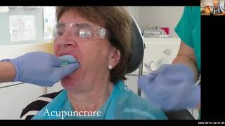 Severe gag reflex  impression making using acupuncture and restoring with a window denture [upl. by Nesyrb541]