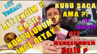 BİTLENDİM   BİT İLAÇLARI KULLANIMI BİT NEREDEN BULAŞIR  OKULDAN BİT BULAŞMASI  EŞYA BİTİ [upl. by Eirrehs79]